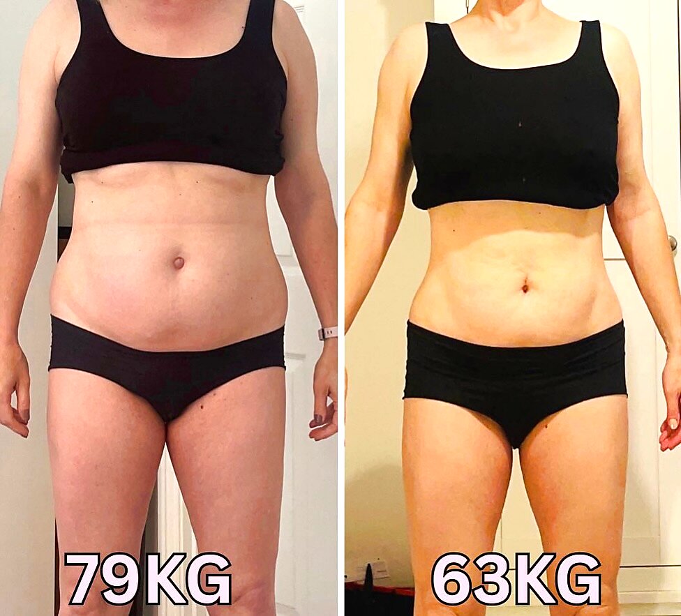 Antes e depois — Teresa, 49