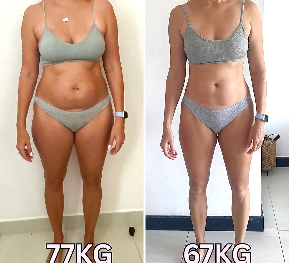 Antes e depois — Sofia, 46