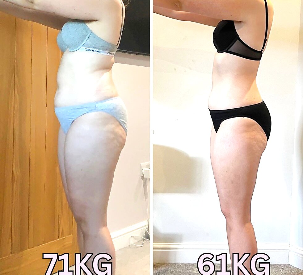 Antes e depois — Rita, 44
