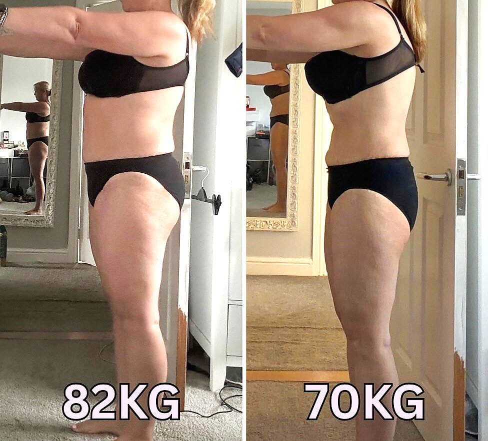 Antes e depois — Alice, 56