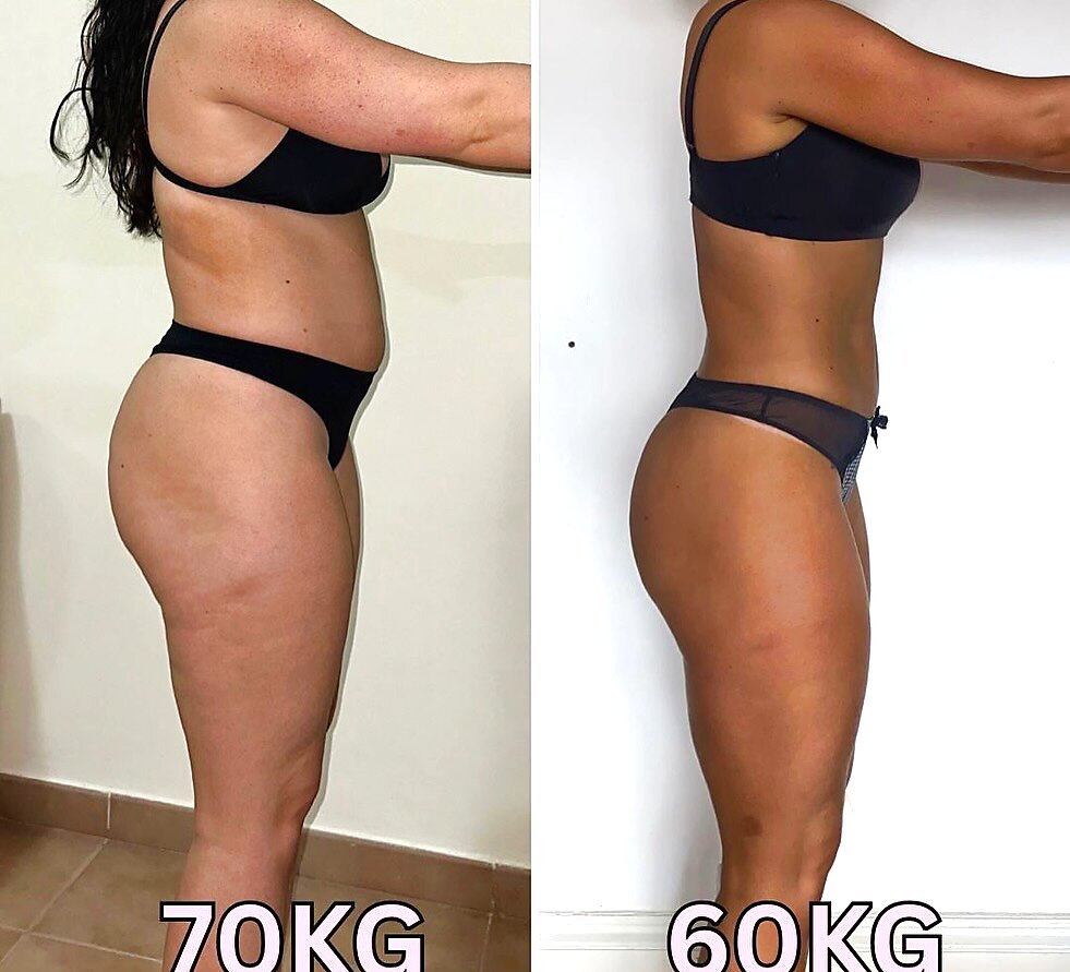 Antes e depois — Carla, 51