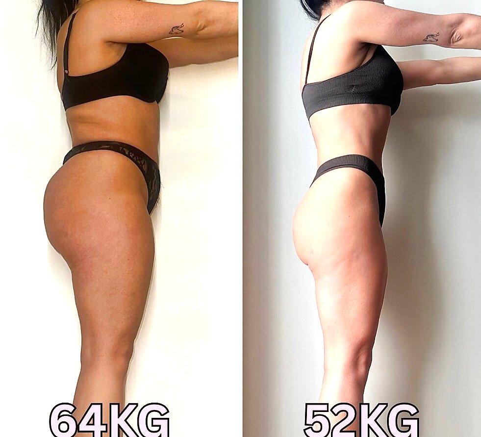 Antes e depois — Inês, 34