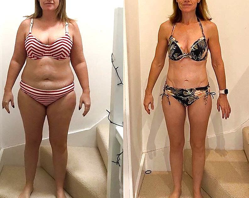 Antes e depois — Sara, 47